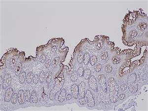 3160B | Control Slides:Immunopathology; Carcinoembryonic Antigen (CEA)